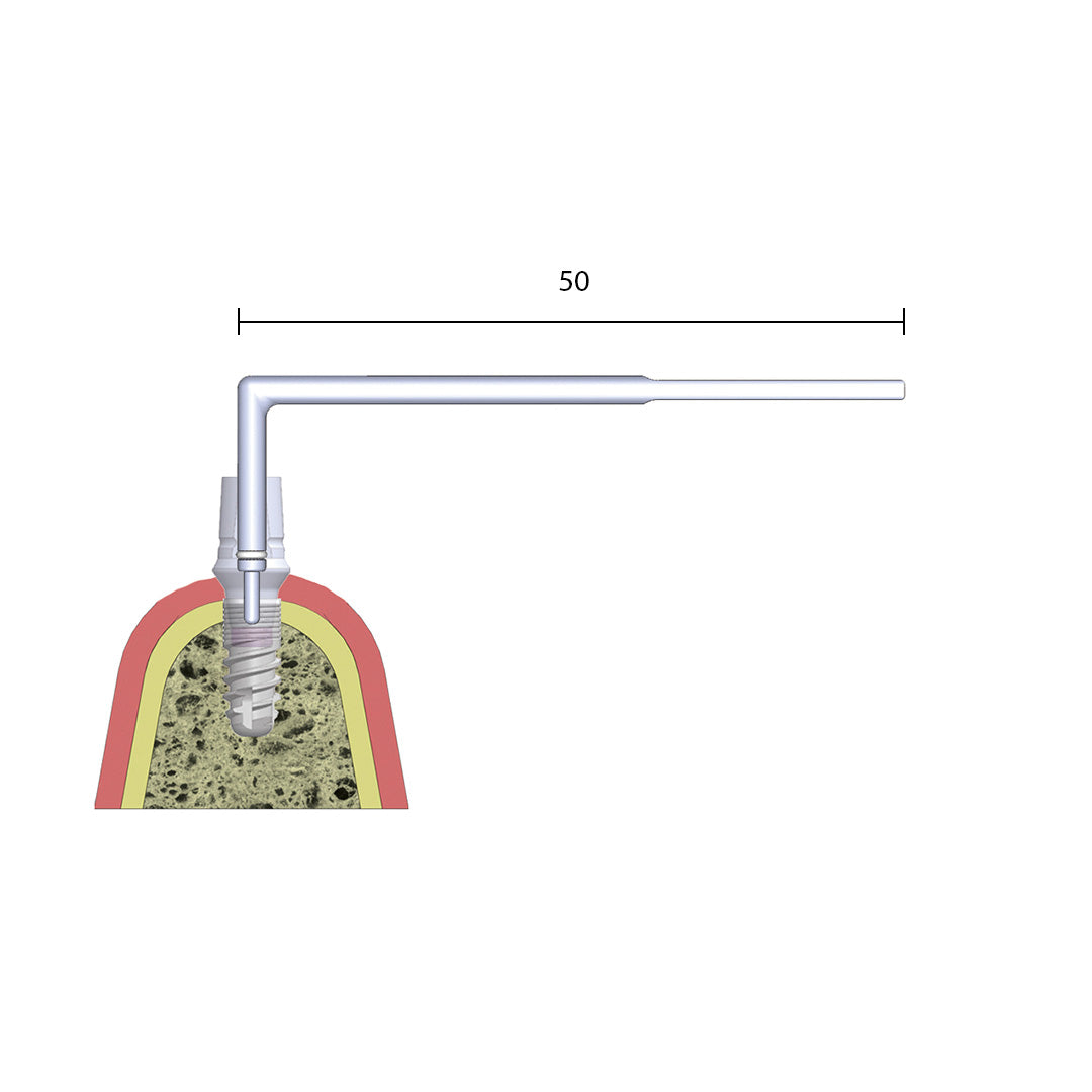 Abutment Remover