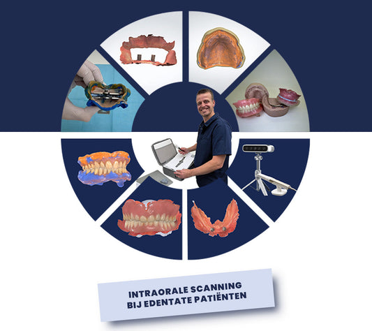 Cursus: Intraorale scanning bij edentate patiënten (BE & NL)