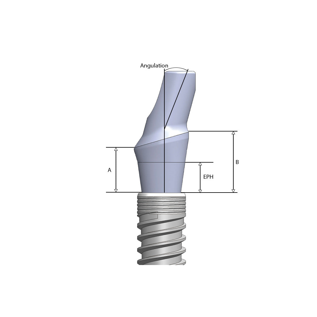 Smart abutments (gehoekt 25°)